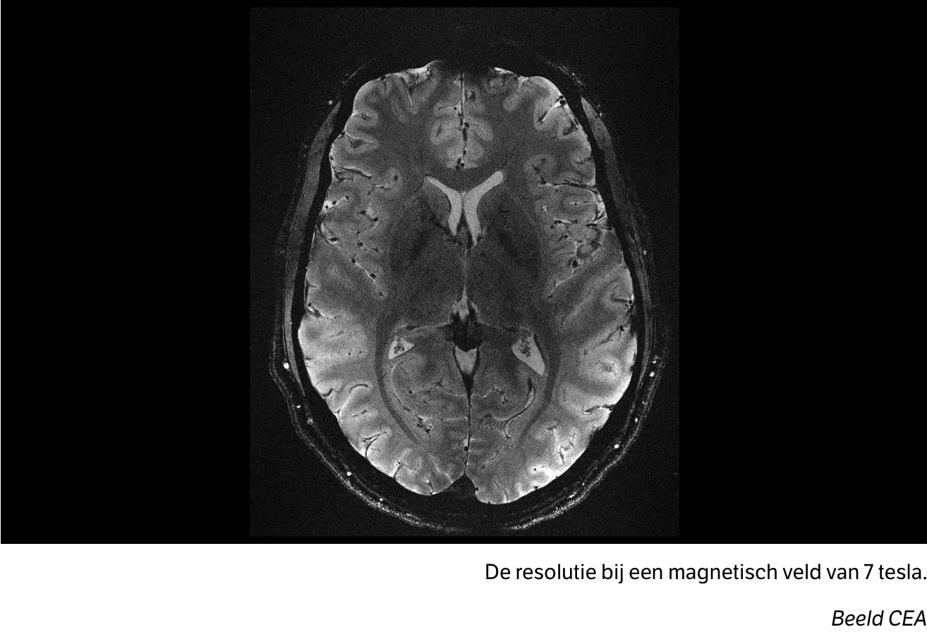 De resolutie bij een magnetisch veld van 7 tesla. Beeld CEA