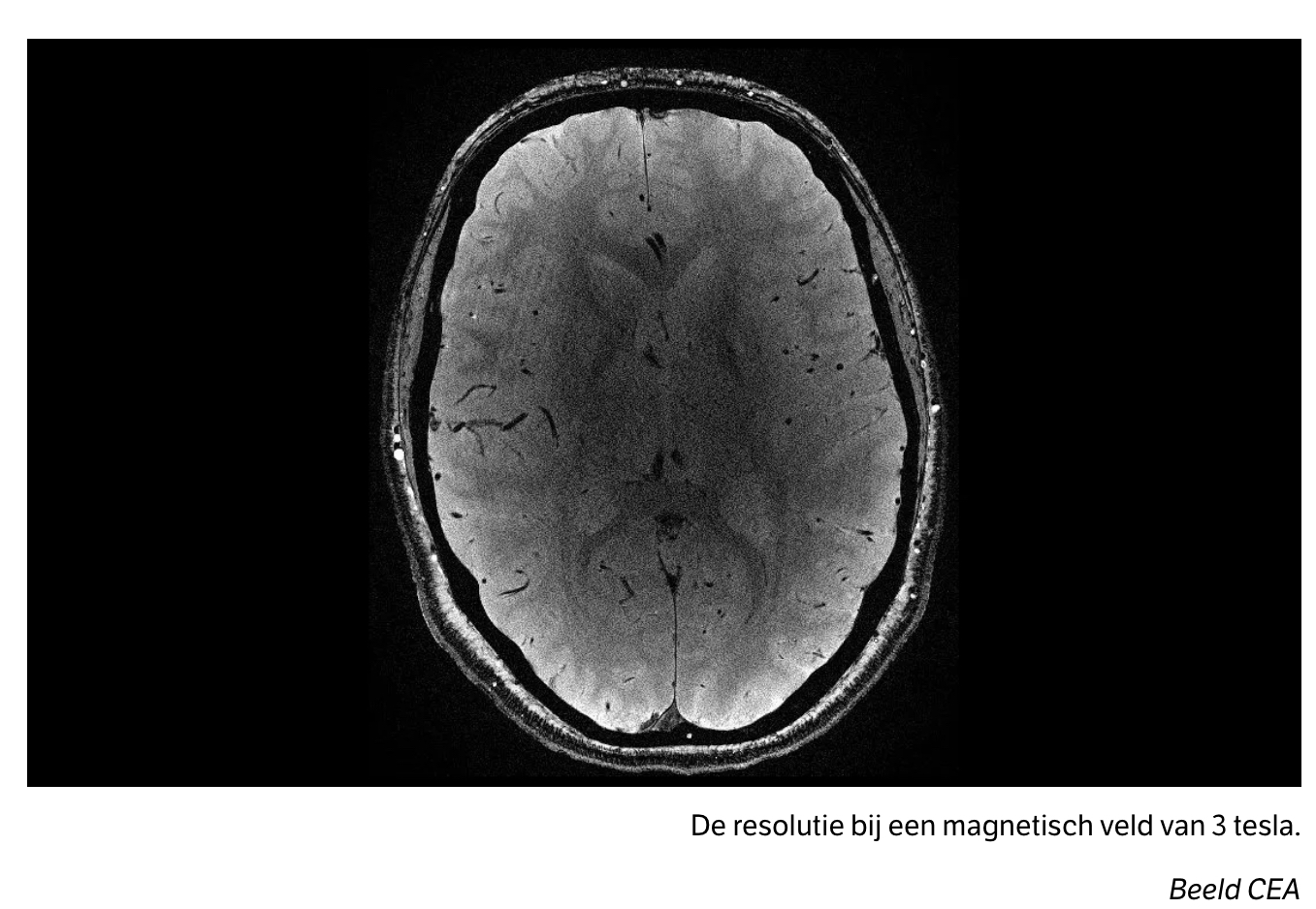 De resolutie bij een magnetisch veld van 3 tesla. Beeld CEA